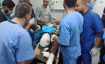 El periodista Ismail Abu Omar debió sufrir la amputación de una pierna y su estado es muy grave, según los médicos del hospital donde es atendido.