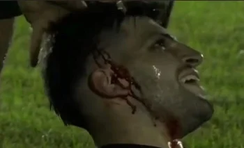 Diego Meirana, de Juanicó, terminó con un corte profundo en su cabeza