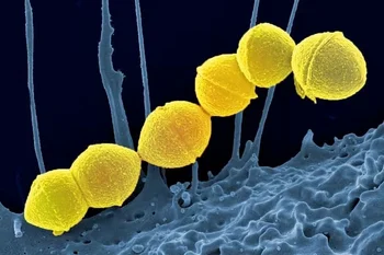 Gran suba de casos por Streptococcus pyogenes