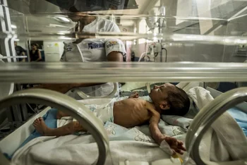 Esteban Granadillo, 18 días, que pesa 1,8 kilos, en el Hospital Universitario de Pediatría en Barquisimeto. Médicos en todo el país dijeron que sus salas de emergencia están abrumadas por niños con desnutrición severa